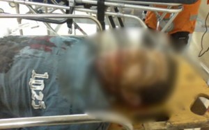 destaque-292462-post-morte