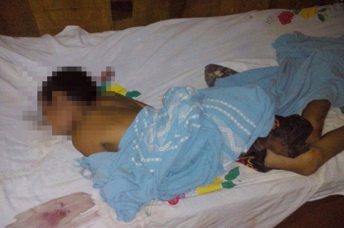 Leonardo Santos de Araújo, 9 anos