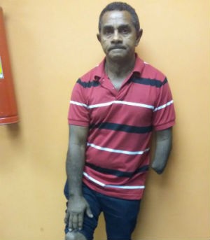 Lauro Rodrigues foi mutilado durante a Guerrilha quando tinha 15 anos